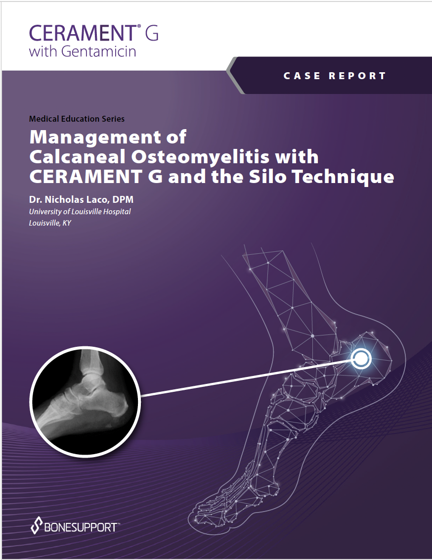 Management of Calcaneal Osteomyelitis with CERAMENT G and the Silo Technique